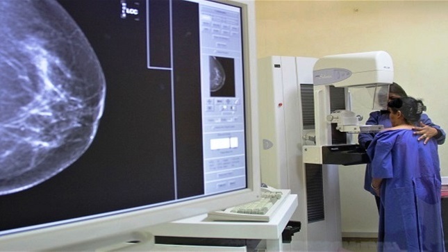 Desarrollan jornada de mamografías gratuitas en Hospital Bertha Calderón