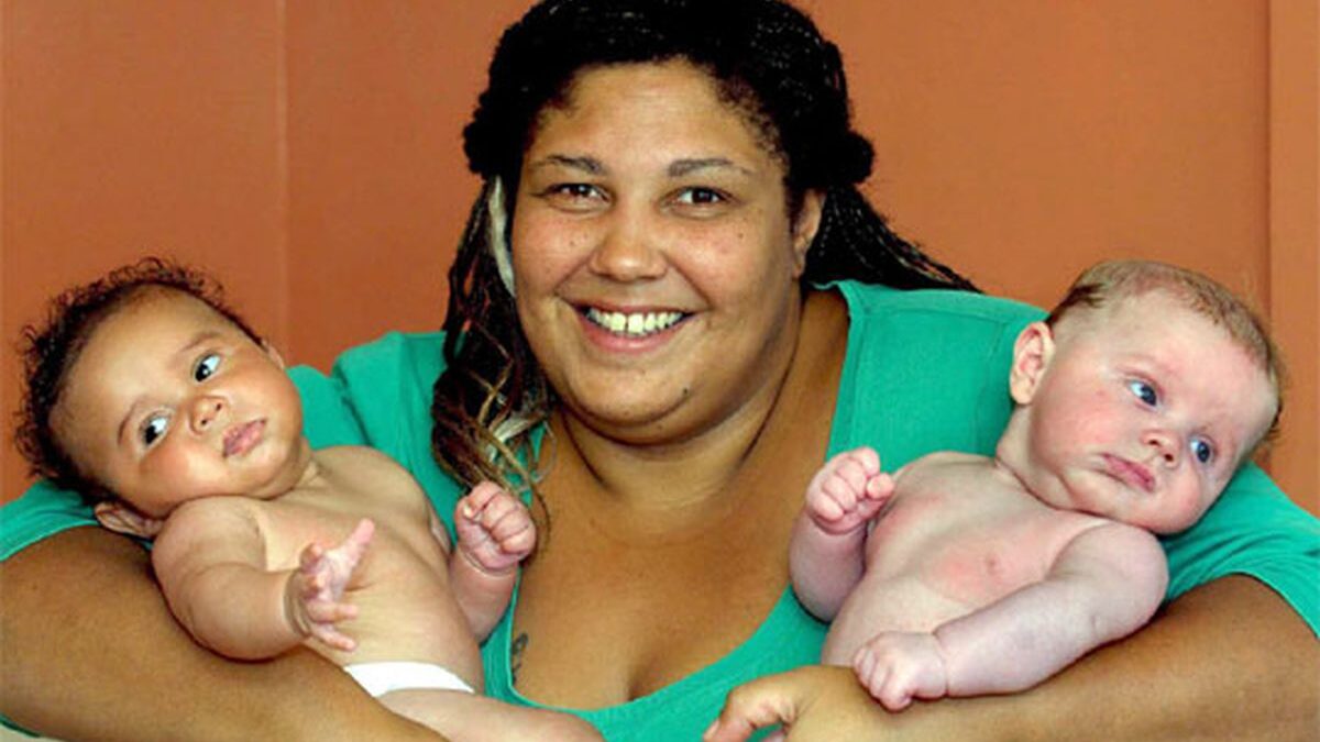 Nacen dos mellizos con distinto color de piel en el Reino Unido