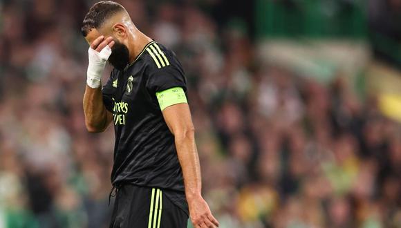 Benzema sale del partido del Celtic vs. Real Madrid por fuerte lesión en una rodilla