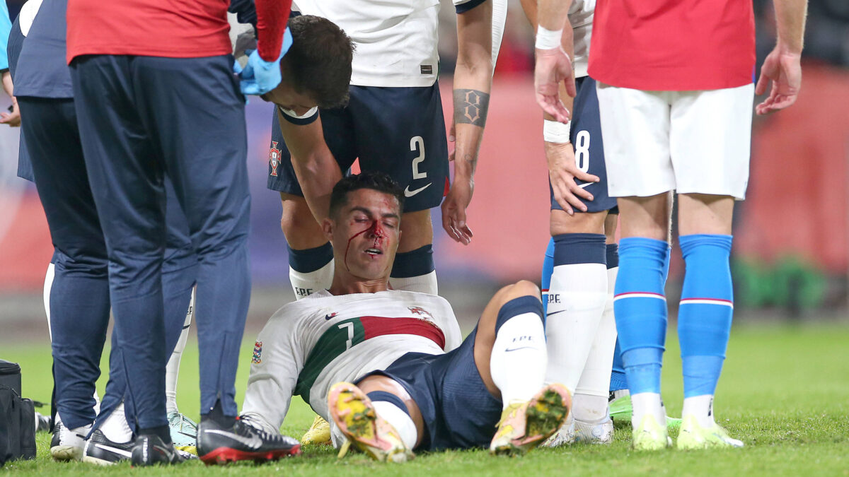 Cristiano sufre fuerte golpe en la nariz durante el partido ante República Checa