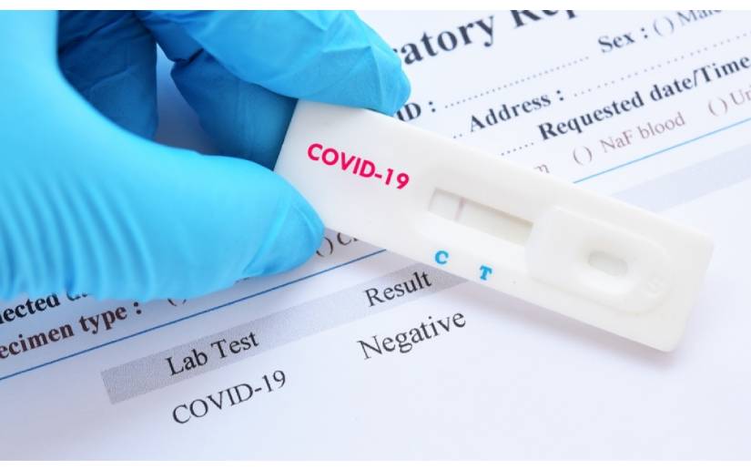Minsa reporta 30 casos positivos de Covid-19 en la última semana