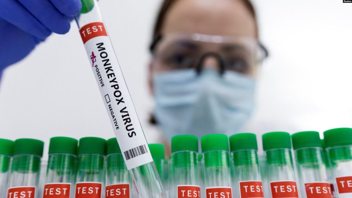 Costa Rica confirma tres nuevos casos de viruela símica