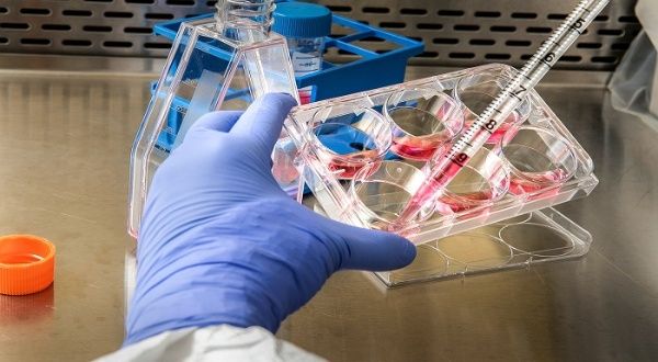 Registran 11 nuevos contagios por viruela símica en Perú