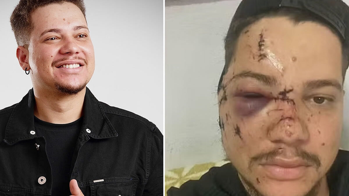 Cantante brasileño agredido en concierto recibe 32 puntos en el rostro