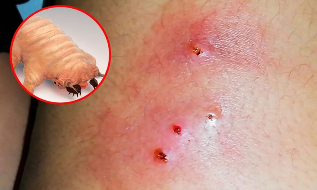 Detectan 20 casos en humanos de gusano barrenador del ganado en Guatemala