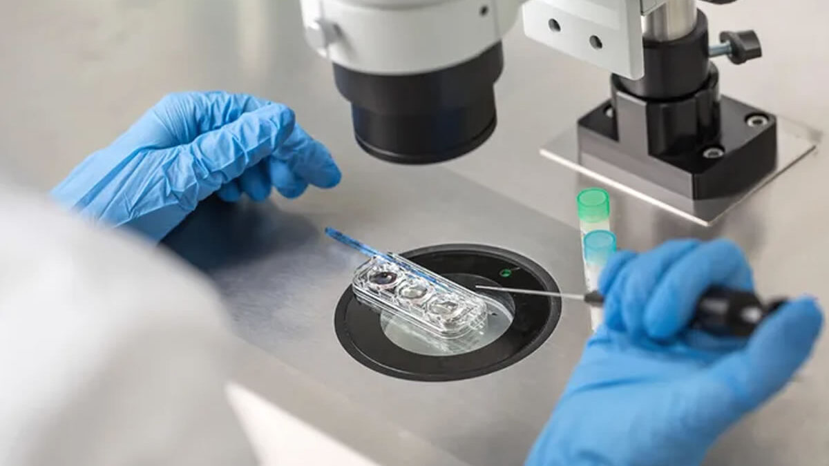 Detectan primer caso de enfermedad genética heredada por donación de esperma